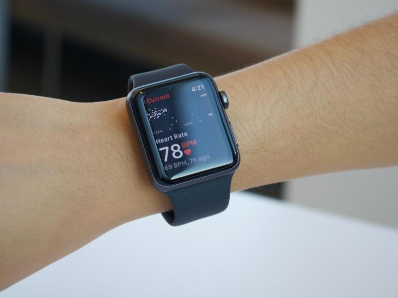 Apple Watch with the Latest Technology for anniversary gifts for girlfriend